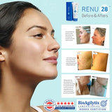 Renu28